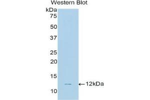 Detection of Recombinant CNP, Human using Polyclonal Antibody to C-Type Natriuretic Peptide (CNP)