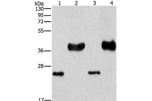 Western Blot analysis of Mouse liver tissue and k562 cell, hela and 293T cell using LIN28B Polyclonal Antibody at dilution of 1:550 (LIN28B Antikörper)