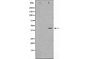 Western blot analysis on COLO205 cell lysate using MAPK3 Antibody,The lane on the left is treated with the antigen-specific peptide. (MAPKAP Kinase 3 Antikörper  (C-Term))