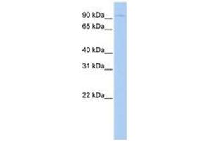 Image no. 1 for anti-Thyroid Stimulating Hormone Receptor (TSHR) (AA 180-229) antibody (ABIN6743075) (TSH receptor Antikörper  (AA 180-229))