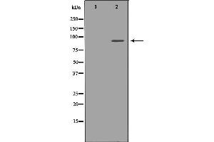 Western blot analysis of extracts of Jurkat, using FGFR1 antibody. (FGFR1 Antikörper  (C-Term))