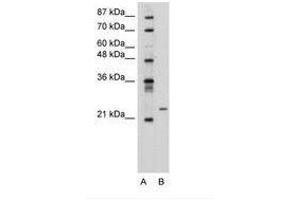 Image no. 2 for anti-Polyamine Modulated Factor 1 (PMF1) (AA 59-108) antibody (ABIN6736312) (PMF1 Antikörper  (AA 59-108))
