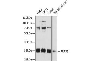 Western blot analysis of extracts of various cell lines, using PRPS2 antibody (ABIN6132522, ABIN6146273, ABIN6146275 and ABIN6216353) at 1:3000 dilution. (PRPS2 Antikörper  (AA 1-240))
