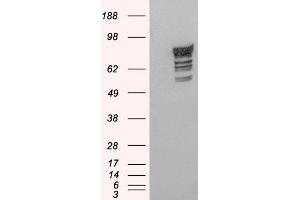 Western Blotting (WB) image for anti-phosphodiesterase 4D, cAMP-Specific (PDE4D) antibody (ABIN5930195) (PDE4D Antikörper)