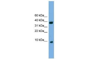 RPS21 antibody used at 1 ug/ml to detect target protein.