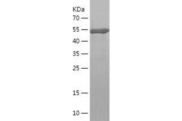 CLIC1 Protein (AA 1-241) (His-IF2DI Tag)