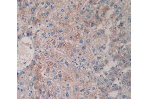 DAB staining on IHC-P; Samples: Human Liver Tissue (TPSAB1 Antikörper  (AA 161-262))