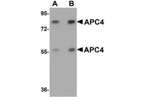 Western blot analysis of APC4 in mouse liver tissue lysate with APC4 antibody at (A) 1 and (B) 2 μg/ml. (ANAPC4 Antikörper  (N-Term))