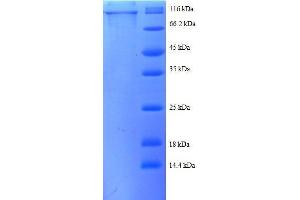 Catenin (Cadherin-Associated Protein), beta 1, 88kDa (CTNNB1) (AA 2-781), (partial) protein (GST tag) (CTNNB1 Protein (AA 2-781, partial) (GST tag))