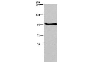 Western Blot analysis of A549 cell using LLGL1 Polyclonal Antibody at dilution of 1:350