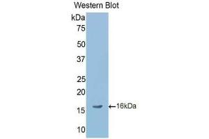 Western blot analysis of the recombinant protein. (LEFTY2 Antikörper  (AA 245-356))