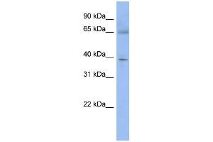 WB Suggested Anti-ZNF302 Antibody Titration:  0. (ZNF302 Antikörper  (N-Term))