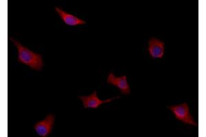 ABIN6259942 and ABIN6277949 staining HepG2 by IF/ICC. (ANO1 Antikörper  (Internal Region))