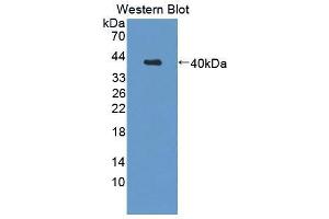 Western blot analysis of the recombinant protein. (Calpain 5 Antikörper  (AA 26-343))