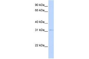 WB Suggested Anti-NKX3-1 Antibody Titration:  0. (NKX3-1 Antikörper  (Middle Region))