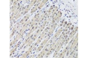 Immunohistochemistry of paraffin-embedded Mouse stomach using FANCL Polyclonal Antibody at dilution of 1:100 (40x lens).
