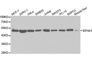Western Blotting (WB) image for anti-Eukaryotic Translation Initiation Factor 4A2 (EIF4A2) antibody (ABIN1876482) (EIF4A2 Antikörper)