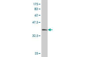 Western Blot detection against Immunogen (36. (PKNOX1 Antikörper  (AA 2-100))
