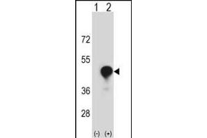 Western blot analysis of CD1C (arrow) using rabbit polyclonal CD1C Antibody (C-term) (ABIN657353 and ABIN2837919). (CD1c Antikörper  (C-Term))