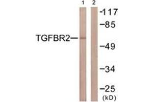 Western blot analysis of extracts from NIH-3T3 cells, using TGF beta Receptor II (Ab-250) Antibody. (TGFBR2 Antikörper  (AA 191-240))
