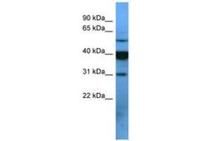 Image no. 1 for anti-Similar To Olfactory Receptor, Family 2, Subfamily T, Member 1 (OR2T1) (C-Term) antibody (ABIN6746554) (OR2T1 Antikörper  (C-Term))
