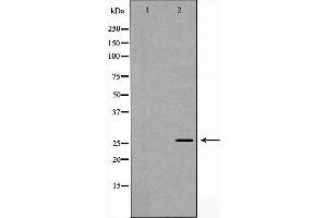 Western blot analysis of recombinant protein using Rabl2 antibody. (Rabl2 Antikörper)