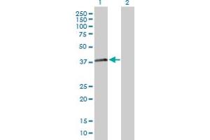 Western Blot analysis of RNF41 expression in transfected 293T cell line by RNF41 MaxPab polyclonal antibody. (RNF41 Antikörper  (AA 1-317))