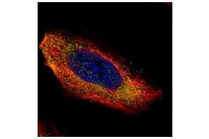 ICC/IF Image Confocal immunofluorescence analysis (Olympus FV10i) of paraformaldehyde-fixed HeLa, using MEK1, antibody (Green) at 1:200 dilution. (MEK1 Antikörper)