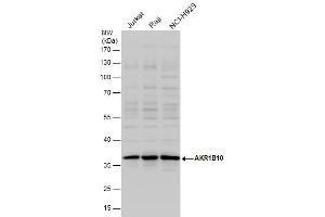 WB Image AKR1B10 antibody detects AKR1B10 protein by western blot analysis. (AKR1B10 Antikörper)