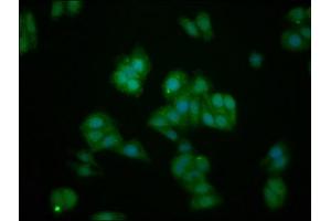 Immunofluorescence staining of HepG2 cells with ABIN7156735 at 1:133, counter-stained with DAPI. (IL1RAPL1 Antikörper  (AA 564-679))