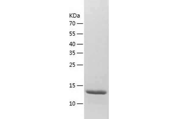 SNIP1 Protein (AA 258-396) (His tag)