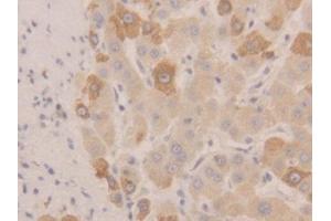 IHC-P analysis of Human Liver Tissue, with DAB staining. (NEU1 Antikörper  (AA 47-415))