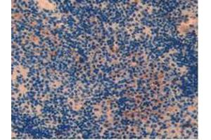 IHC-P analysis of Mouse Spleen Tissue, with DAB staining. (PARP1 Antikörper  (AA 661-881))