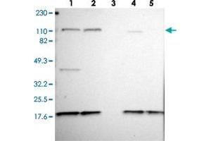 Western blot analysis of Lane 1: RT-4, Lane 2: U-251 MG, Lane 3: Human Plasma, Lane 4: Liver, Lane 5: Tonsil with KIF5A polyclonal antibody . (KIF5A Antikörper)