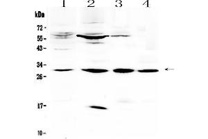 Western blot analysis of VEGFB using anti-VEGFB antibody . (VEGFB Antikörper  (AA 25-138))