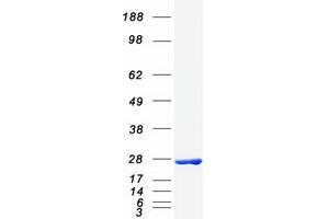 Western Blotting (WB) image for Myosin, Light Chain 3 (MYL3) protein (Myc-DYKDDDDK Tag) (ABIN2726663)