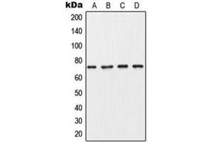 Western blot analysis of Collagen 8 alpha 1 expression in MDA-MB453 (A), A549 (B), SP2/0 (C), PC12 (D) whole cell lysates.