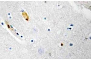 Immunohistochemistry (IHC) analyzes of TCF-3 antibody in paraffin-embedded human brain tissue. (TCF3 Antikörper)