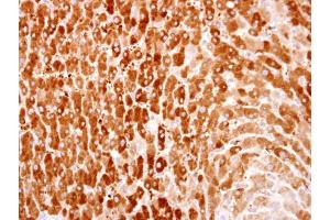 Immunohistochemistry (IHC) image for anti-2-Hydroxyacyl-CoA Lyase 1 (HACL1) (C-Term) antibody (ABIN2856448)