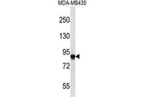 AFAP1 Antibody (C-term) western blot analysis in MDA-MB435 cell line lysates (35 µg/lane). (AFAP Antikörper  (C-Term))