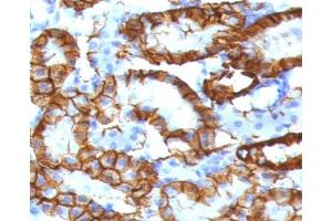 IHC testing of FFPE mouse kidney tissue with recombinant Cadherin 16 antibody (clone KSCP2-2R).