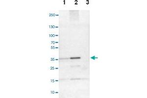 Western blot analysis of Lane 1: NIH-3T3 cell lysate (Mouse embryonic fibroblast cells), Lane 2: NBT-II cell lysate (Rat Wistar bladder tumour cells), Lane 3: PC12 cell lysate (Pheochromocytoma of rat adrenal medulla) with CREM polyclonal antibody. (CREM Antikörper)