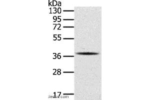 Western blot analysis of A375 cell, using SPARC Polyclonal Antibody at dilution of 1:400 (SPARC Antikörper)