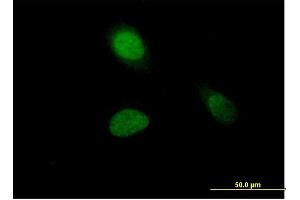 Immunofluorescence of purified MaxPab antibody to HIST1H1A on HeLa cell.