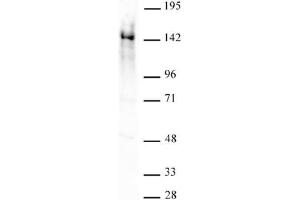 Ubn1 antibody (pAb) tested by Western blot. (Ubinuclein 1 Antikörper  (AA 1-345))