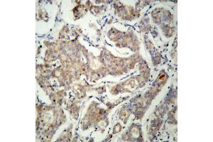 Image no. 2 for anti-BCL2-Associated Agonist of Cell Death (BAD) antibody (ABIN265323) (BAD Antikörper)