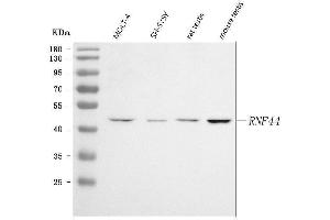 Western blot analysis of RNF44 using anti-RNF44 antibody (ABIN7601901).