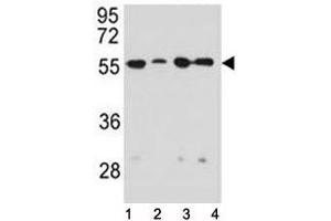 Vimentin antibody western blot analysis in 1) HeLa, 2) U251, 3) A549, and 4) MDA-MB231 lysate (Vimentin Antikörper)
