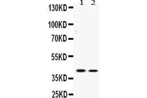Western blot analysis of ATF4 expression in U2OS whole cell lysates ( Lane 1) and SW620 whole cell lysates ( Lane 2). (ATF4 Antikörper  (N-Term))