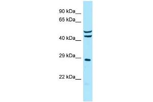 Host: Rabbit Target Name: MRPS7 Sample Type: MCF7 Whole Cell lysates Antibody Dilution: 1. (MRPS7 Antikörper  (C-Term))